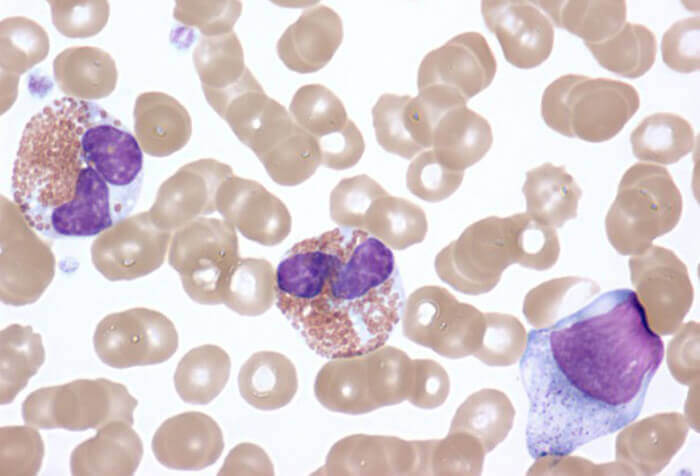 eosinophils