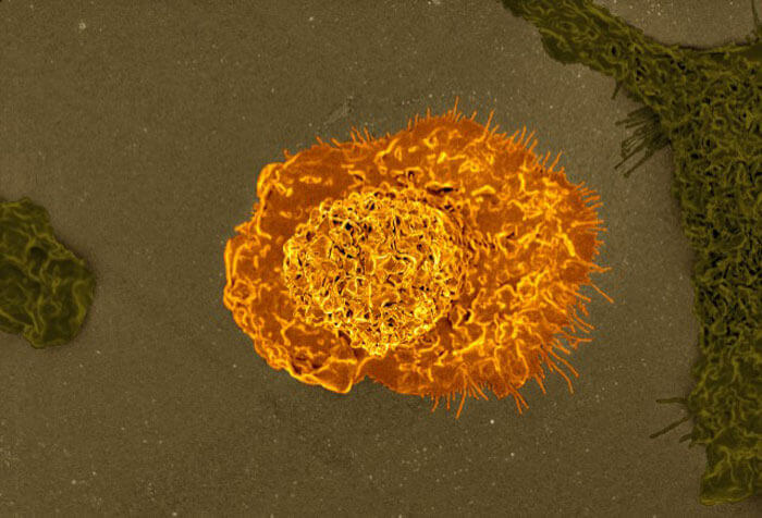 macrophages