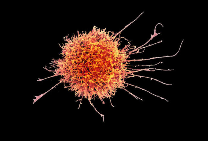 natural killer cell