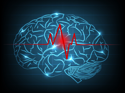 UAB does first radiofrequency ablation for epilepsy in Alabama