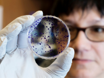UAB joins research network dedicated to improving treatments for brain tumors