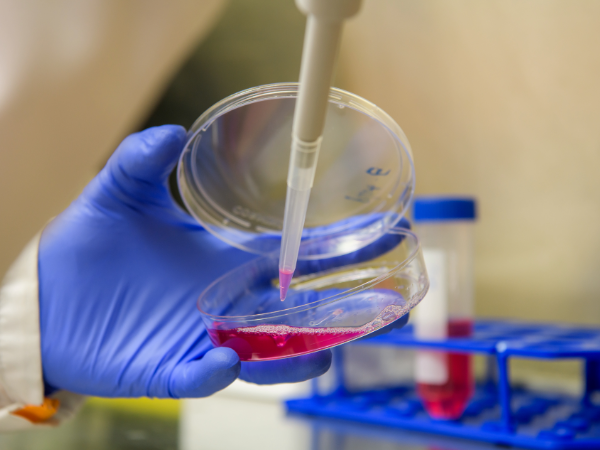 Image of a researcher using a pipette to fill a lab dish