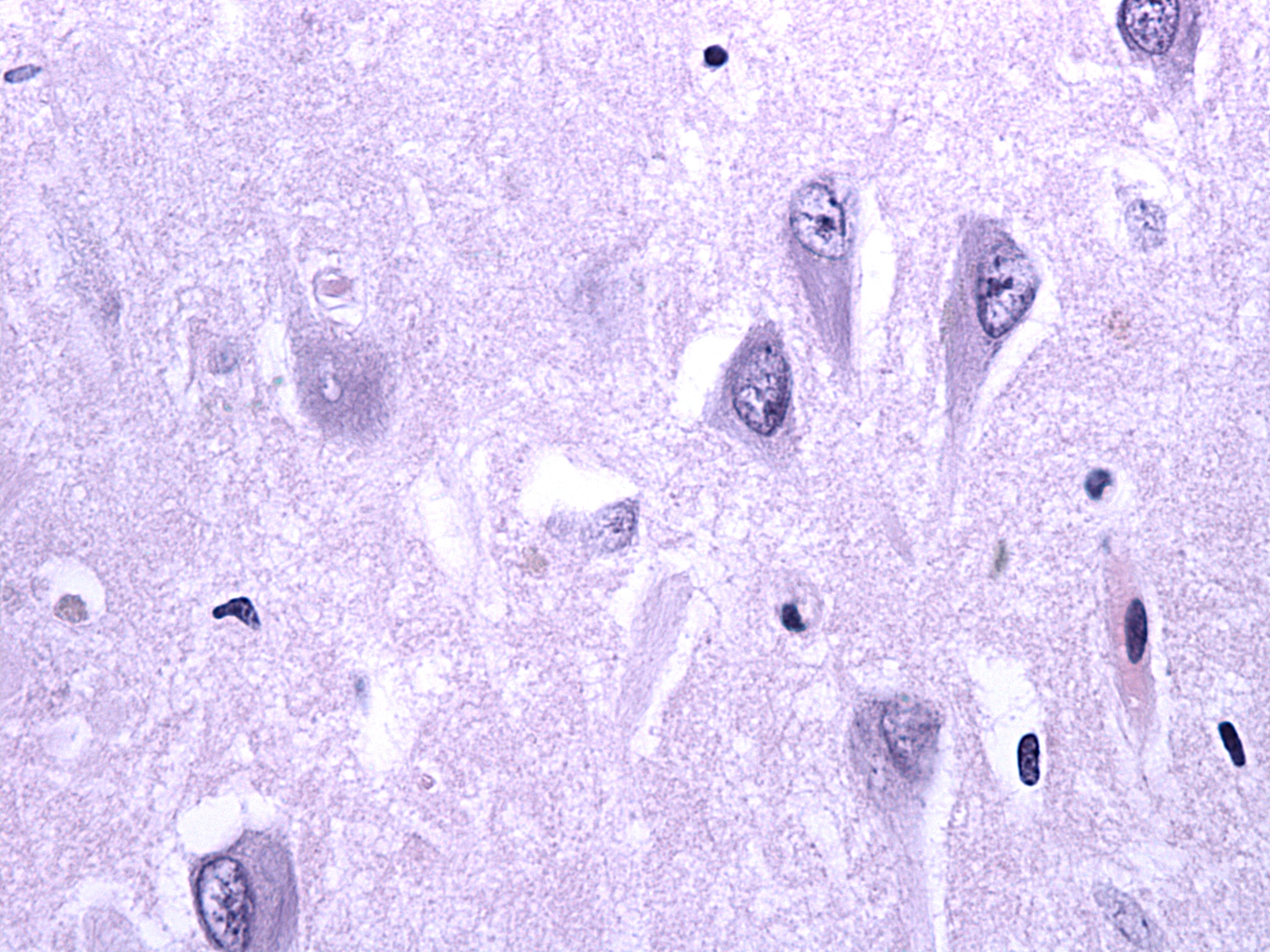 Fig 3 Neocortex