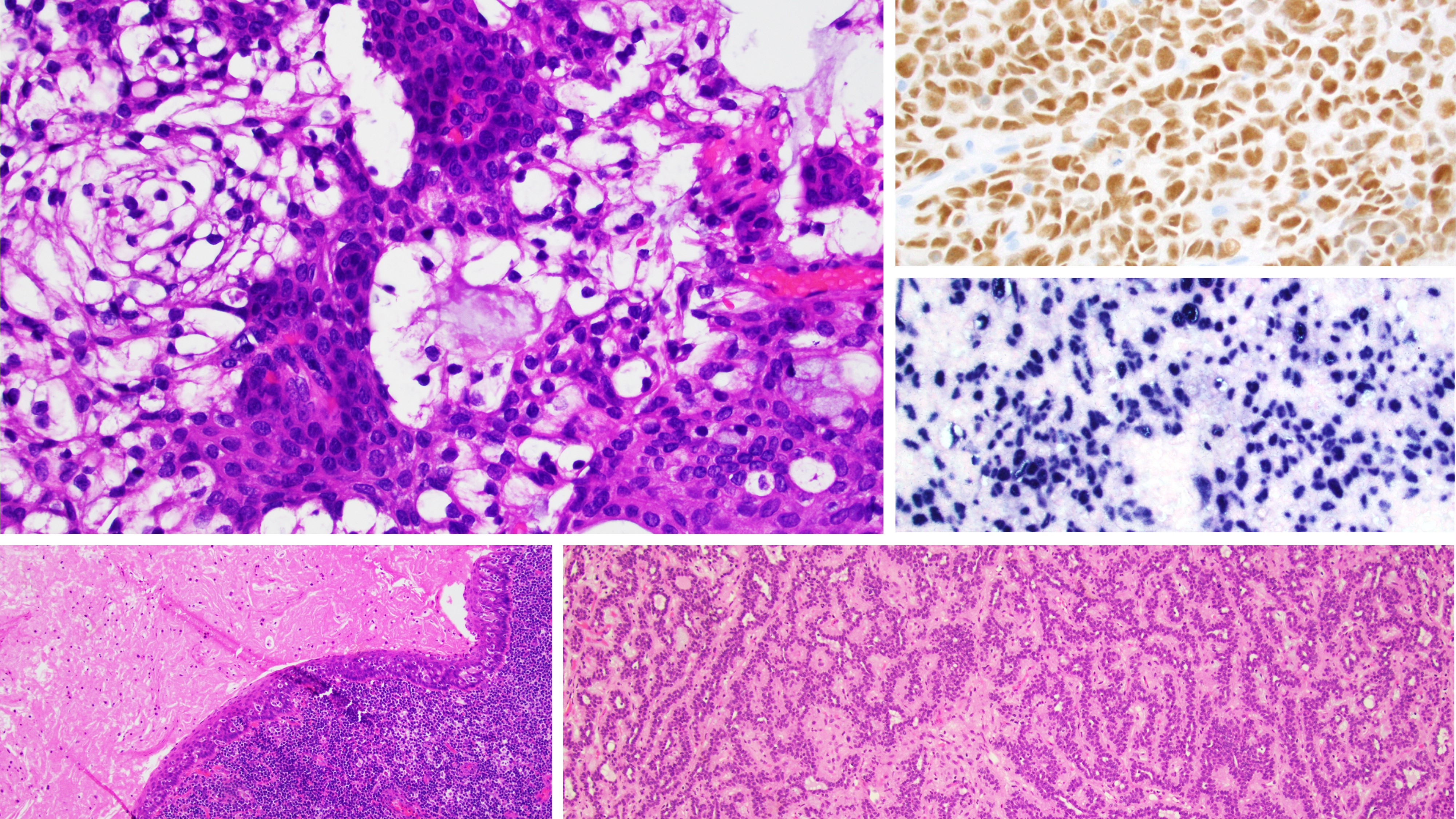 Head and Neck Banner