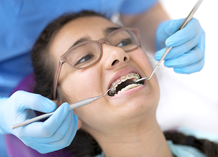 Braces2