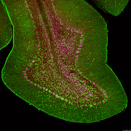 Inside immunofluorescence staining 