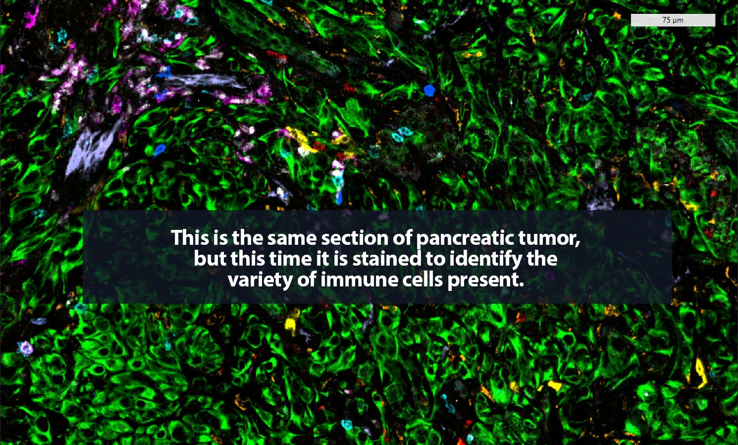 1 alt full immune 1490x898px