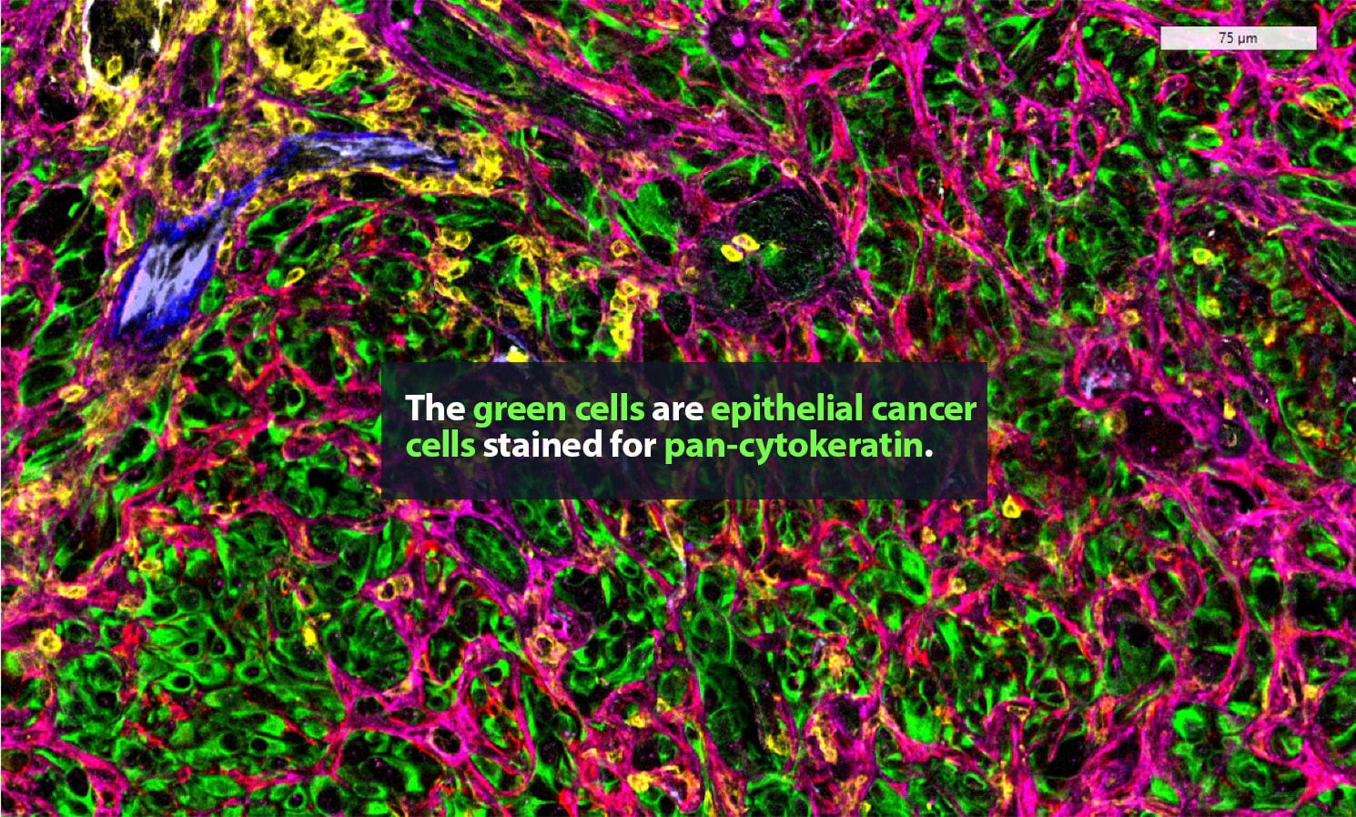 2 green stroma 1490x898px