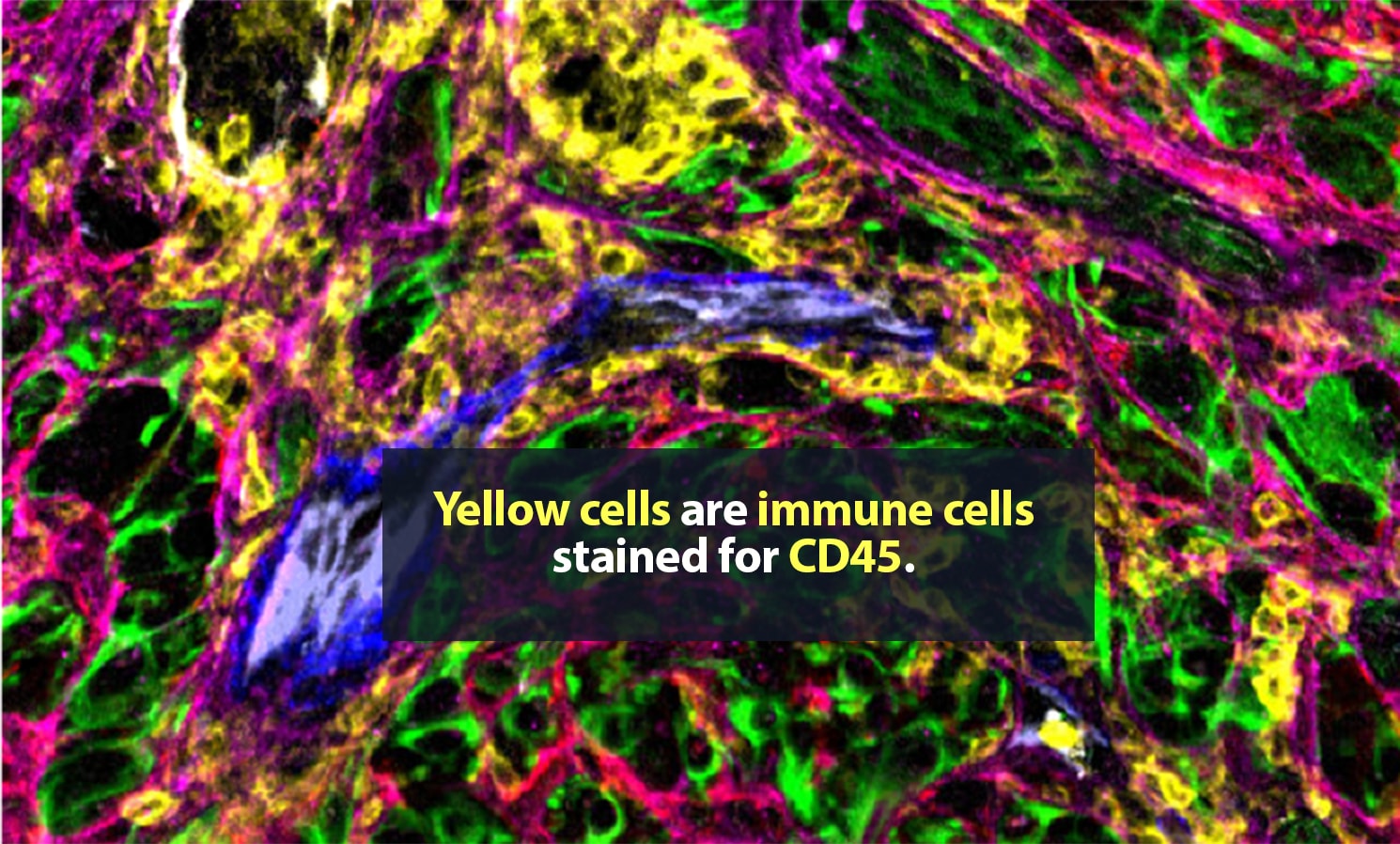 3 alt rep yellow stroma 1490x898px