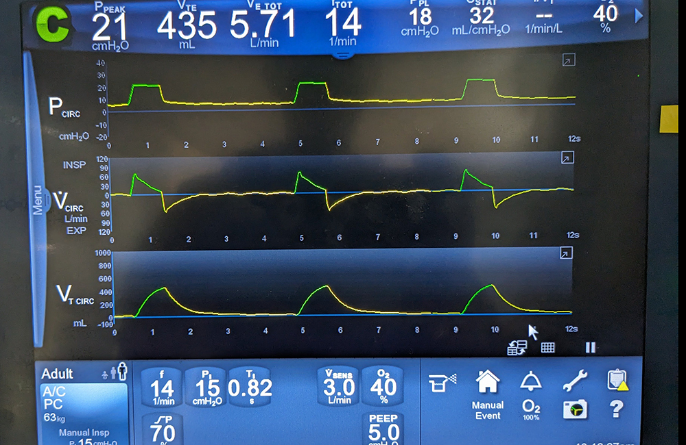 rep normal ac pc 1000px